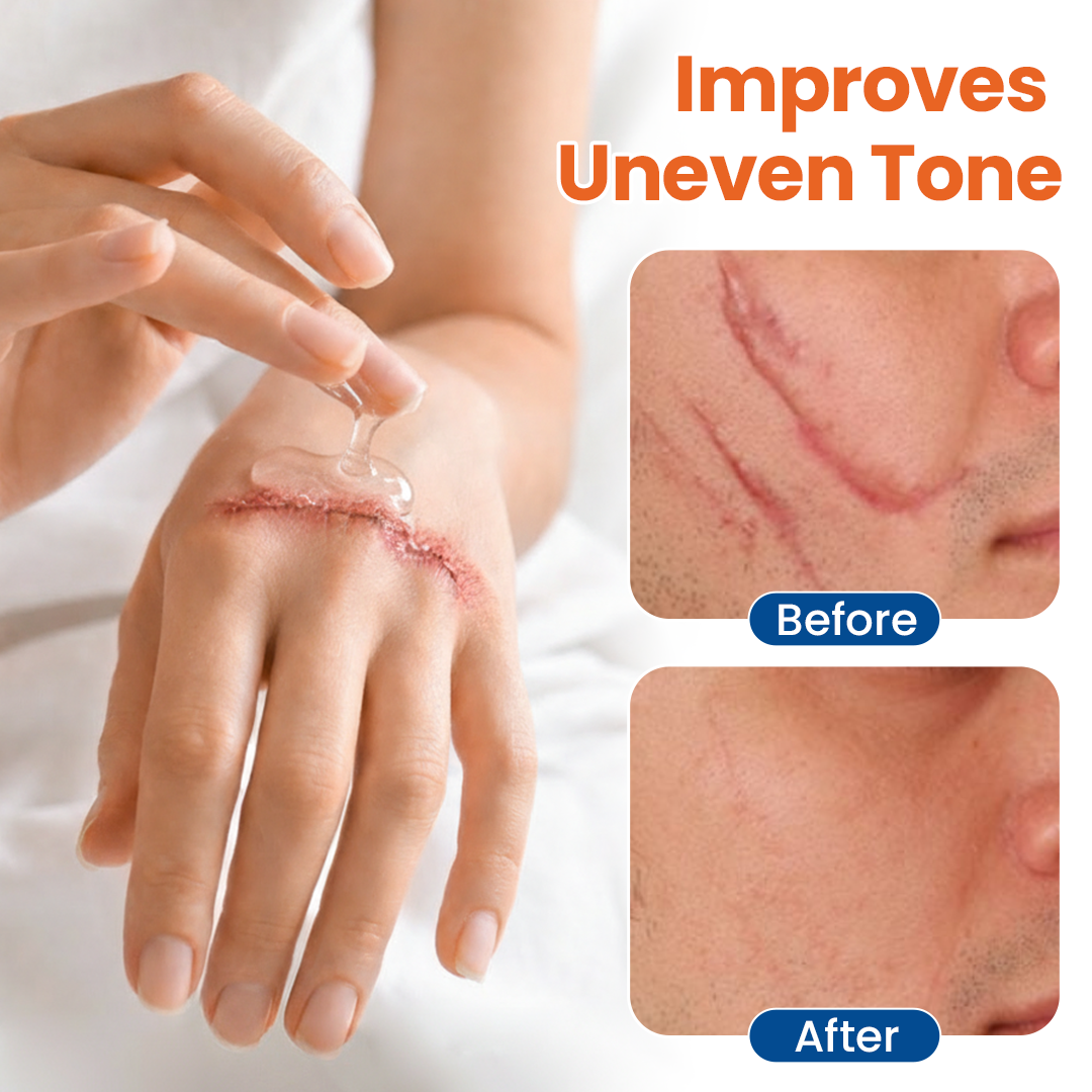 👨‍⚕LUMIVO® DermalRebuild Skin Renewal Gel-👍visible smoothing &fading in the first 7 days pf use